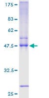 Human TWIST2 Protein (Recombinant GST)