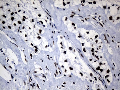 Monoclonal Mouse anti-Human POLR2A / RNA polymerase II Antibody (clone OTI3C8, aa1351-1614, IHC, WB)