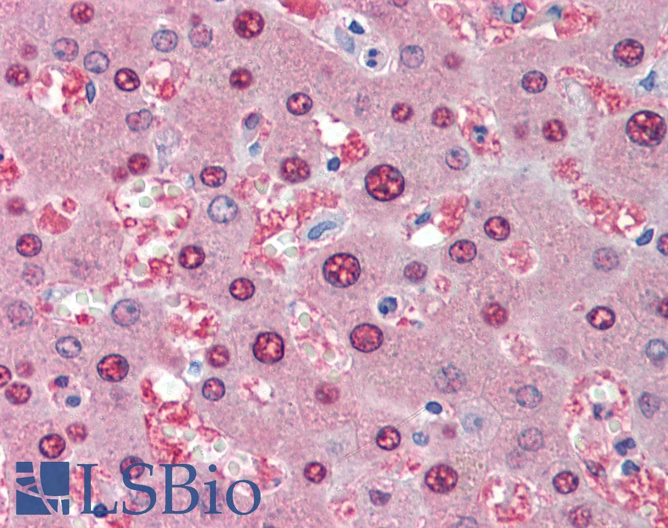 IHC-plus™ SOD1 / Cu-Zn SOD Antibody