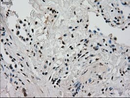 Monoclonal Mouse anti-Human GCK / Glucokinase Antibody (clone OTI3E3, IHC, IF, WB)