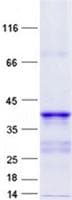 Human MPV17L Protein (Recombinant GST, N-terminus + His, C-terminus)