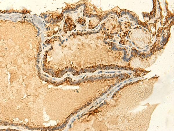 Polyclonal Rabbit anti-Human GLYATL2 Antibody (IHC)