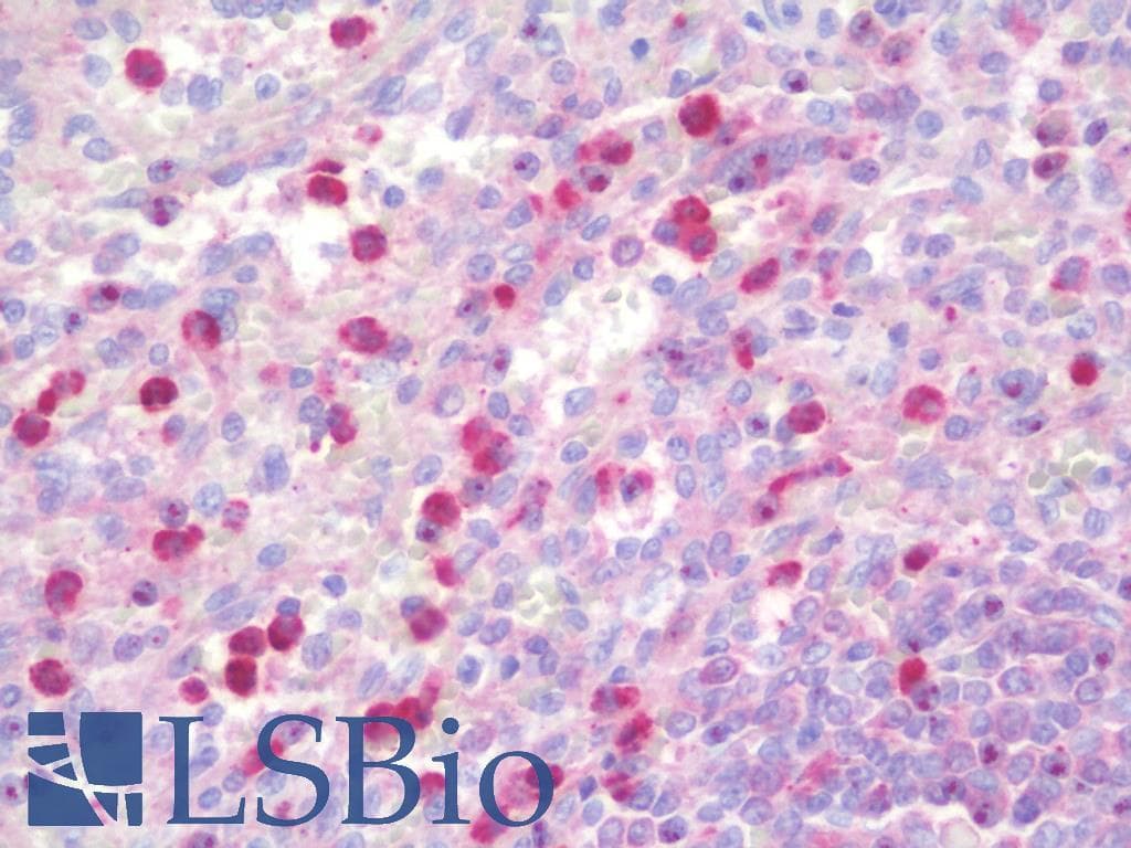 IHC-plus™ DQX1 Antibody (aa551-600)