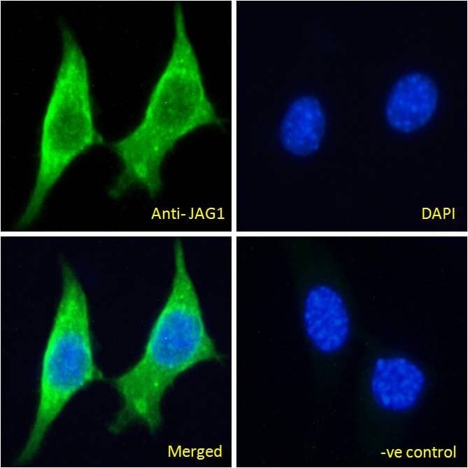 IHC-plus™ Polyclonal Goat anti-Human JAG1 / Jagged 1 Antibody (aa1197-1210, IHC, IF)