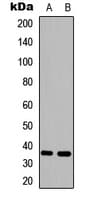 Polyclonal Rabbit anti-Human HSD11B1 / HSD11B Antibody (N-Terminus, WB)
