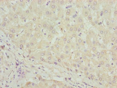 Polyclonal Rabbit anti-Human DHRS3 / SDR1 Antibody (IHC, WB)