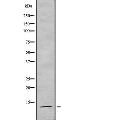 SNRPD3 Antibody