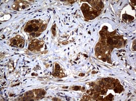 NME1 / NM23 Antibody (clone OTI1A12)