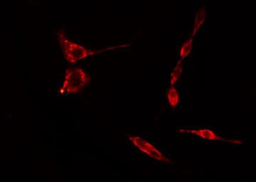 RPS15 / Ribosomal Protein S15 Antibody