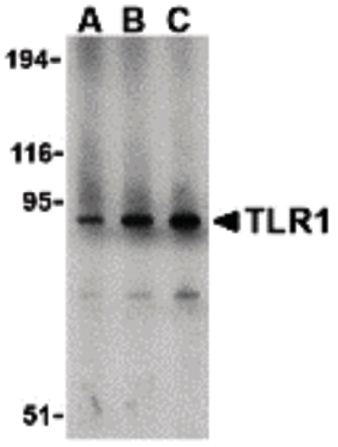 IHC-plus™ TLR1 Antibody