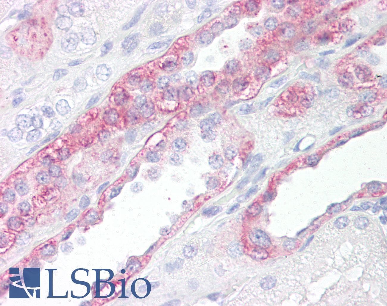IHC-plus™ Polyclonal Rabbit anti-Human FABP7 / BLBP / MRG Antibody (aa80-130, IHC, WB)