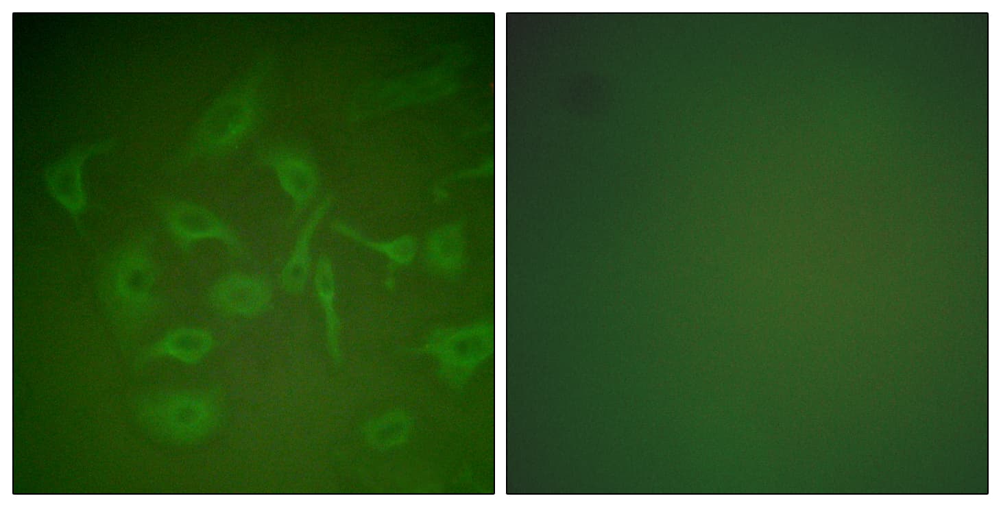 SCGB2A2 / Mammaglobin A Antibody (aa41-90)