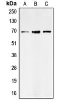 IHC-plus™ Polyclonal Rabbit anti-Human SLC6A1 / GAT-1 Antibody (Internal, IHC, WB)