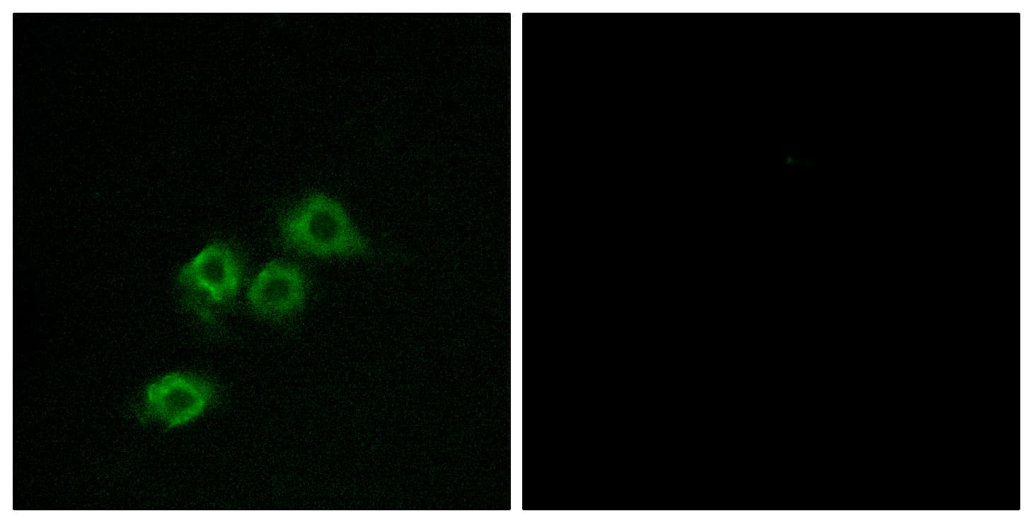 GPR1 Antibody (aa121-170)
