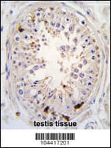 USP2 Antibody (aa508-538)