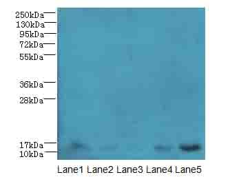 TIMM10B / FXC1 Antibody