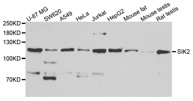 SIK2 / SNF1LK2 Antibody