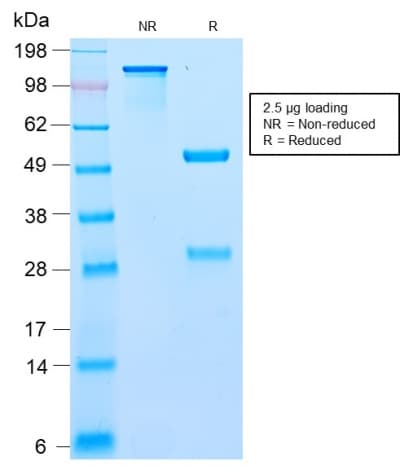 Recombinant Monoclonal Rabbit anti-Human BCL10 / BCL-10 Antibody (clone BL10/2988R, aa122-168, IHC, IF)
