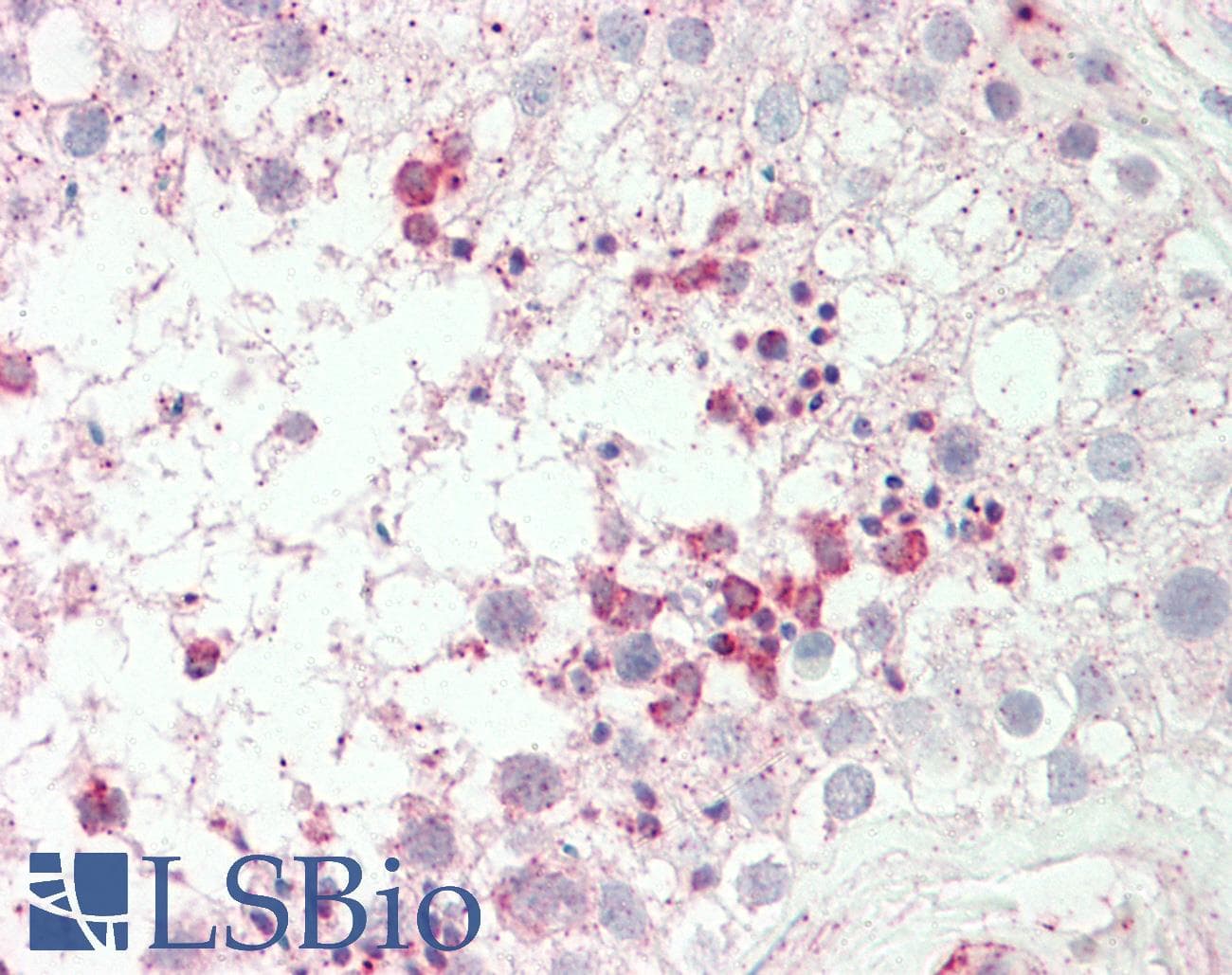 IHC-plus™ Polyclonal Rabbit anti-Human Acrosin Antibody (aa387-416, IHC, WB)