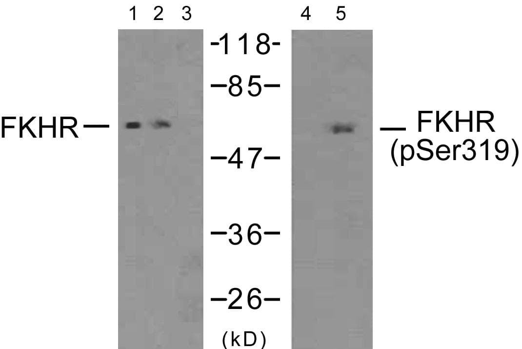 FOXO1 / FKHR Antibody (phospho-Ser319)