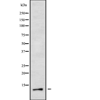 Polyclonal Rabbit anti-Human COX8A Antibody (WB)