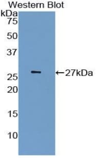 Latexin / MUM Antibody (aa1-223, APC)