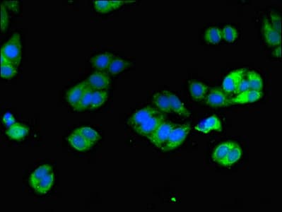 Polyclonal Rabbit anti-Human DPYD / DPD Antibody (IF)