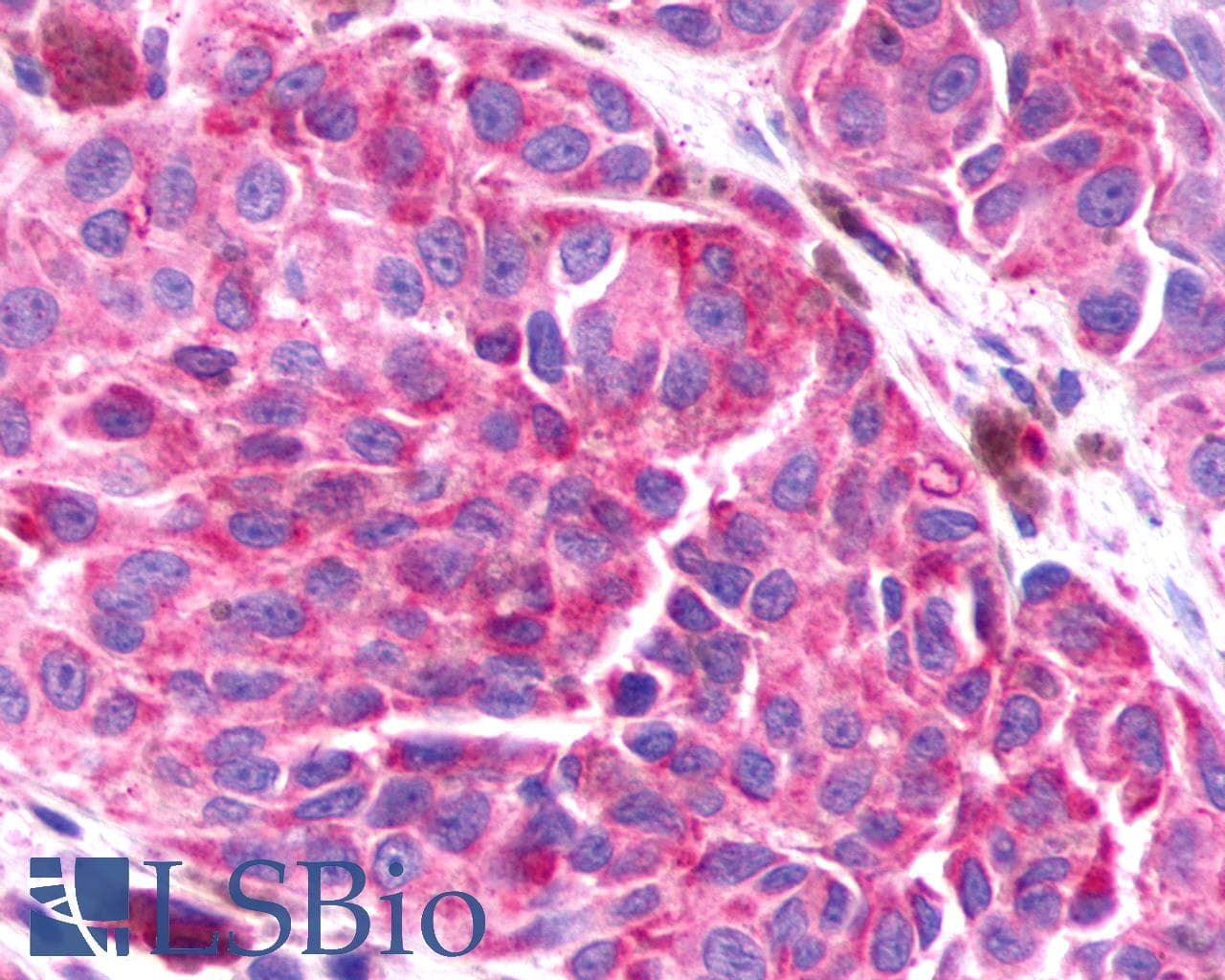 PathPlus™ Polyclonal Rabbit anti-Human ADGRB3 / BAI3 Antibody (Cytoplasmic Domain, IHC)