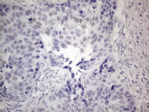 FOS / c-FOS Antibody (clone OTI1E3)