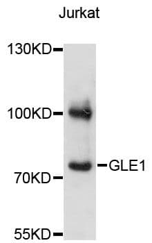 Polyclonal Rabbit anti-Human GLE1 Antibody (WB)