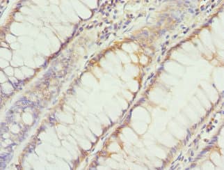 HDS / DHDDS Antibody