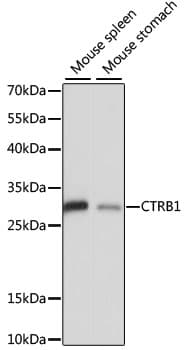 CTRB1 / Chymotrypsinogen B1 Antibody