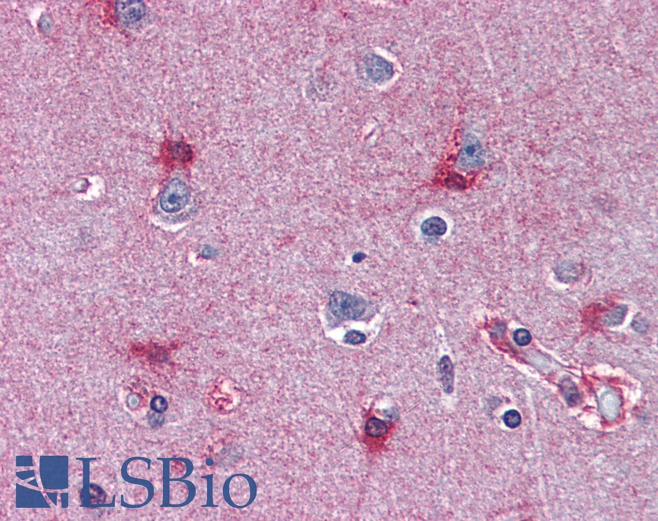 IHC-plus™ Monoclonal Mouse anti-Human MAT2A Antibody (clone AT3A2, aa1-395, IHC, WB)