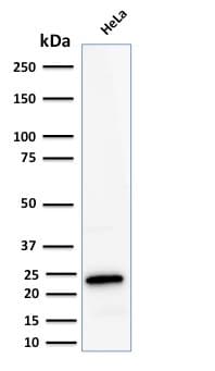 PathPlus™ Recombinant Monoclonal Rabbit anti-Human FTL / Ferritin Light Chain Antibody (clone FTL/2338R, aa 38-165, IHC, WB)
