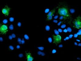 Monoclonal Mouse anti-Human SPINT1 / HAI-1 Antibody (clone OTI4E1, IHC, IF, WB)