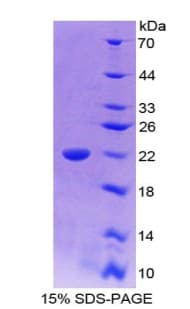 Bovine IL18 Protein (Recombinant His-T7)