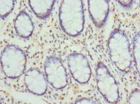 Polyclonal Rabbit anti-Human CYTH2 / Cytohesin 2 Antibody (IHC, WB)