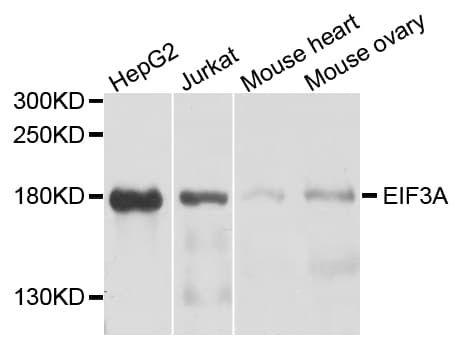 Polyclonal Rabbit anti-Human EIF3A Antibody (IHC, IF, WB)