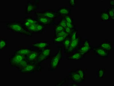 IHC-plus™ HIF1A / HIF1 Alpha Antibody (aa 579-826)
