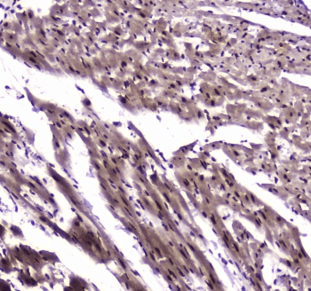 Polyclonal Rabbit anti-Human NFIB Antibody (IHC, WB)