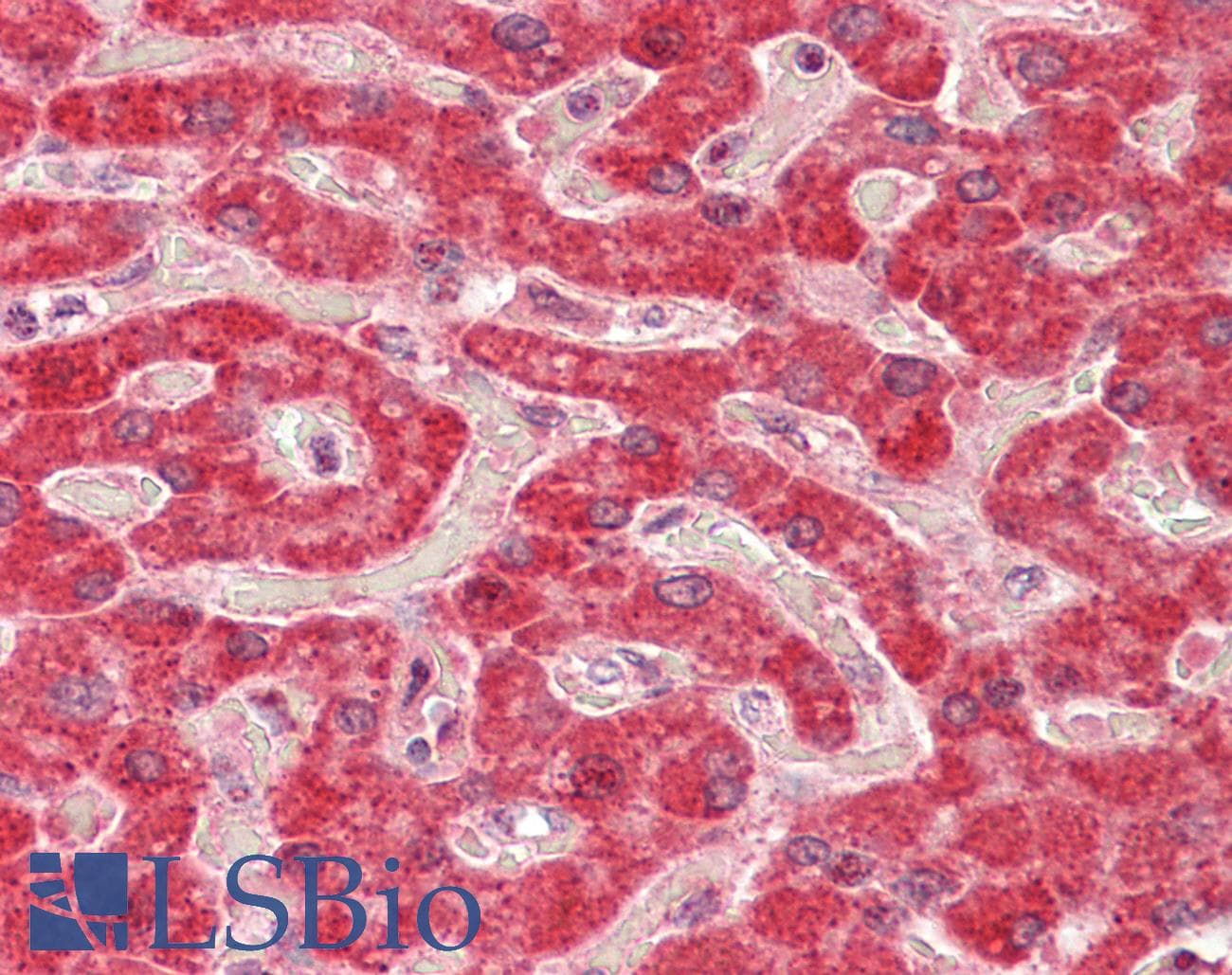 IHC-plus™ Polyclonal Goat anti-Human ALDH5A1 Antibody (aa301-312, IHC, WB)