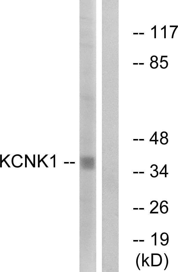 TWIK1 / KCNK1 Antibody (aa287-336)