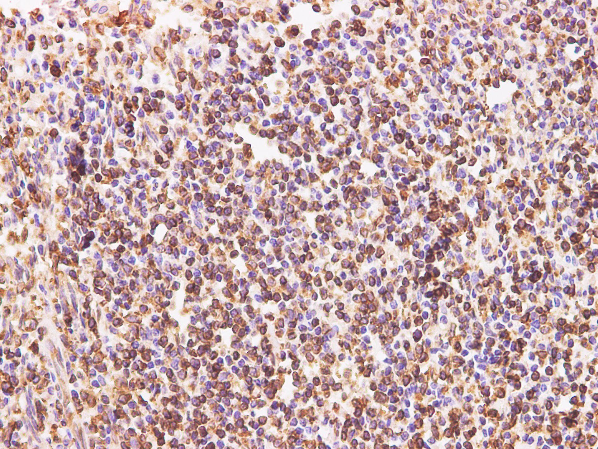CD74 / CLIP Antibody