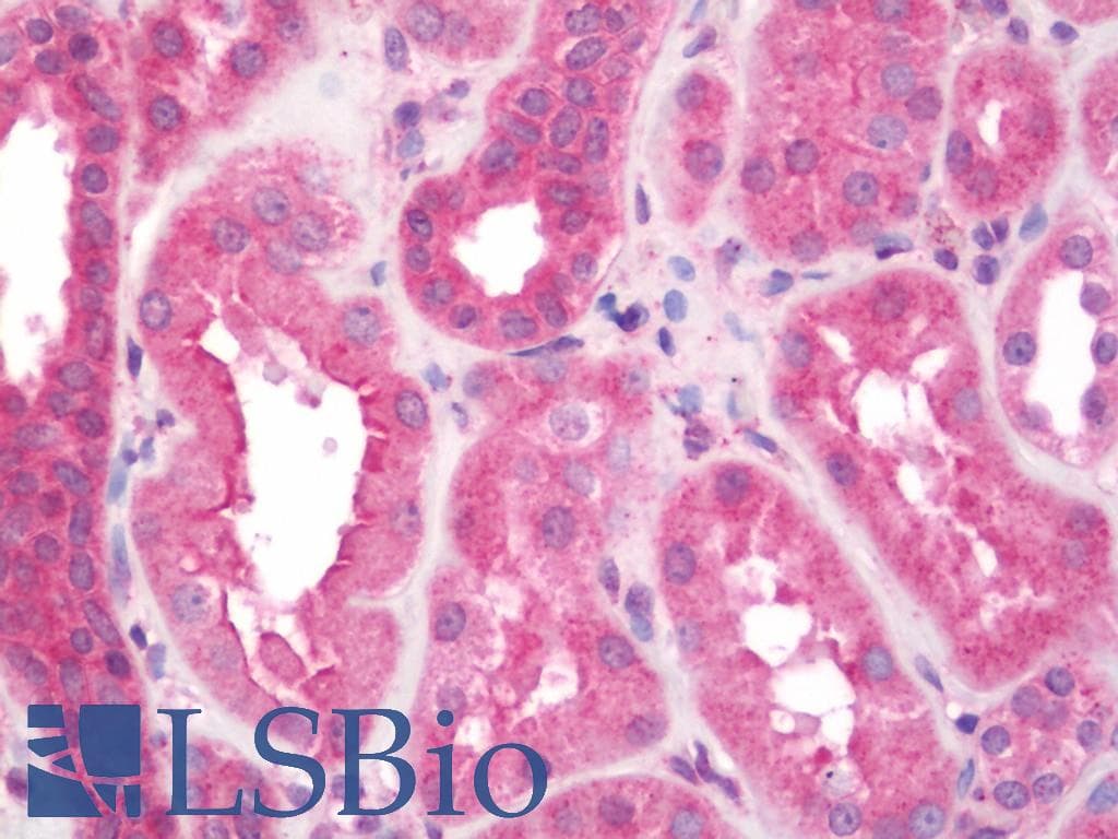 IHC-plus™ Polyclonal Rabbit anti-Human SACM1L / SAC1 Antibody (aa408-436, IHC, WB)