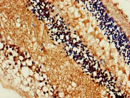 Polyclonal Rabbit anti-Human SLC16A8 Antibody (IHC, IF, WB)