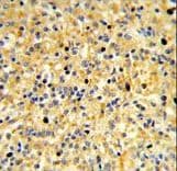 CCDC3 Antibody (aa195-222)