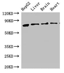 KLKB1 / Plasma Kallikrein Antibody