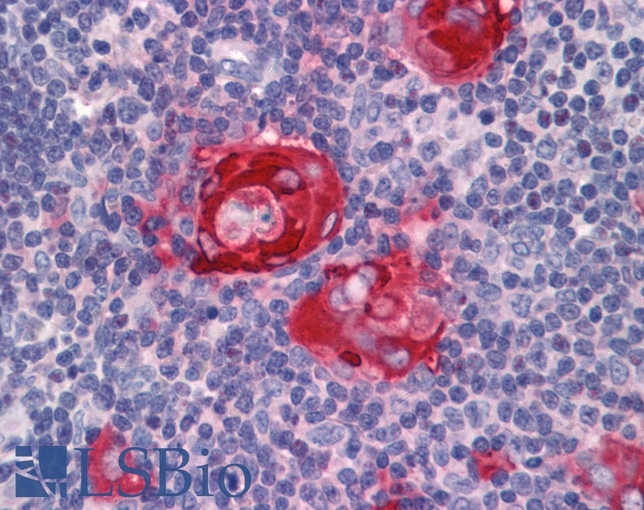 ZFP36 / Tristetraprolin Antibody (aa41-90)