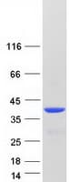 Human VSX1 Protein (Recombinant Myc-DDK (Flag))