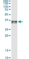 PRSS8 / Prostasin Antibody (clone 3C4)